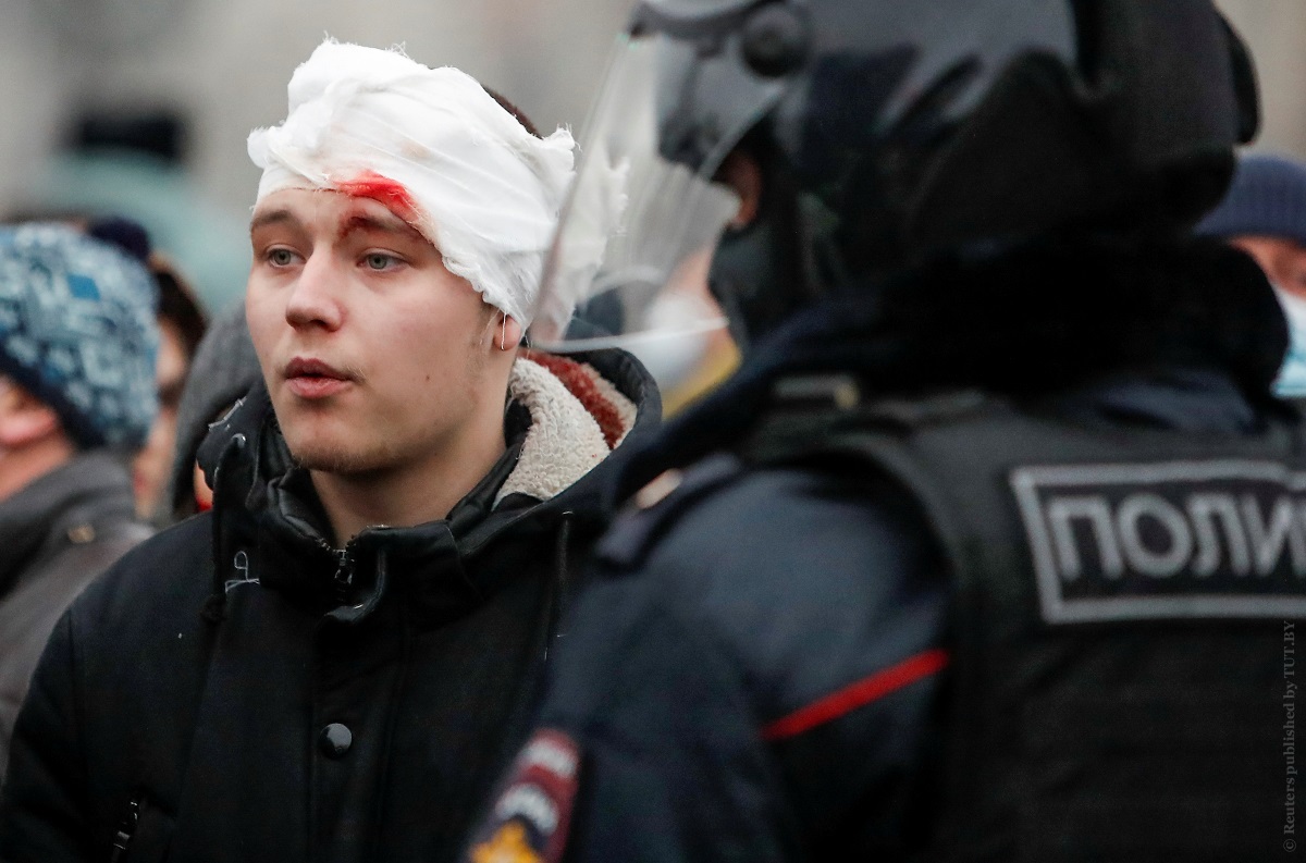 В-Москве-на-массовой-акции-пострадали-более-40-человек.-Полиция-по-каждому-случаю-проводит-проверку