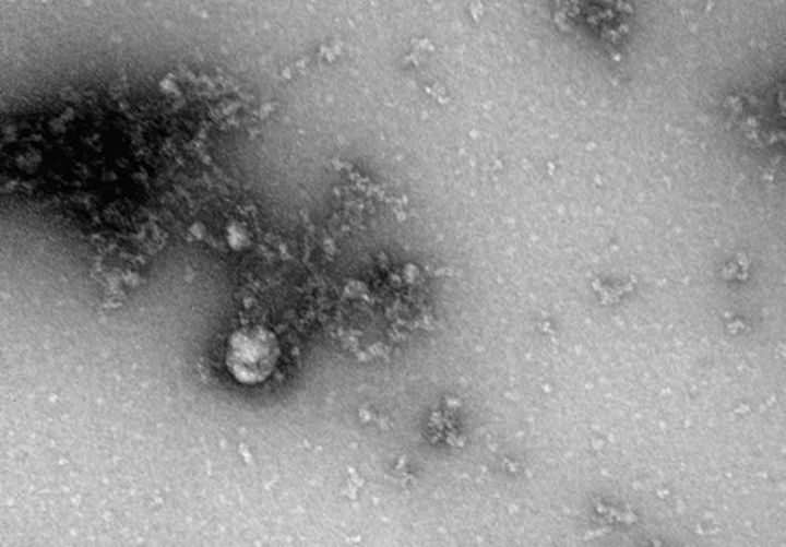 Что-науке-известно-о-новых-штаммах-коронавируса?-Отвечает-профессор-из-Канады