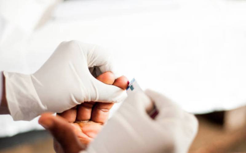 why-that-negative-hiv-test-results-could-actually-be-positive