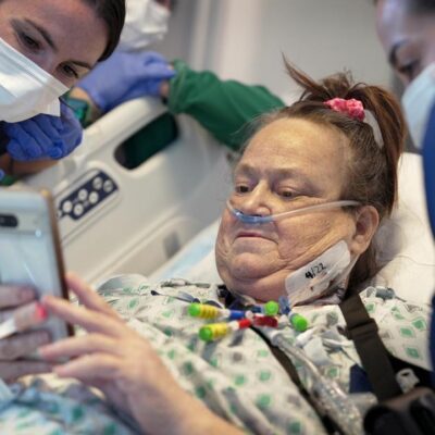lisa-(54)-fikk-operert-inn-grisenyre-i-historisk-transplantasjon