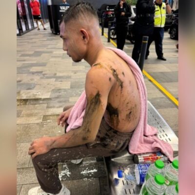 national-footballer-suffers-acid-attack-at-klang-valley-mall