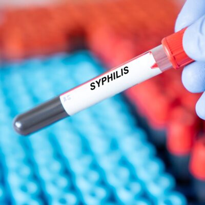 “ingrijorari-majore”-din-cauza-celor-8-milioane-de-cazuri-de-infectare-cu-sifilis-pe-an.-semnal-de-alarma-tras-de-oms