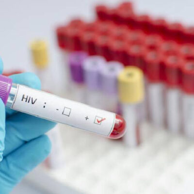 controversy-over-procurement-of-hiv-testing-kits