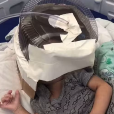 hospital-en-brasil-uso-caja-de-pastel-como-mascara-de-oxigeno-para-atender-a-un-bebe