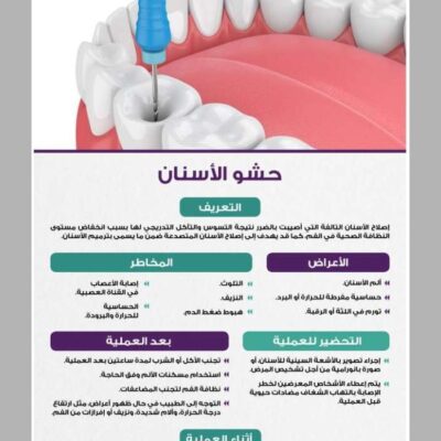 إنفوجرافيكس.-حشو-الأسنان