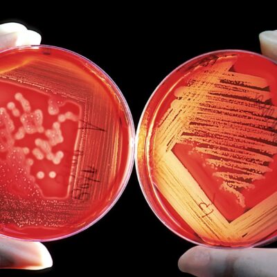 que-es-la-listeria-y-como-afecta-a-las-personas-esta-bacteria-por-la-que-el-minsal-emitio-una-alerta-sanitaria