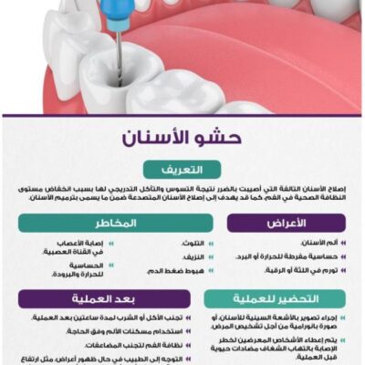 إنفوجرافيكس.-حشو-الأسنان